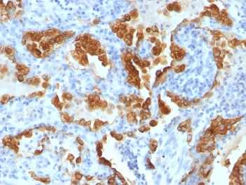 Cytokeratin 8 Antibody Cocktail