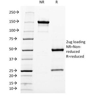 Neurofilament Antibody / Heavy