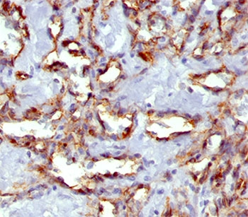 PECAM-1 Antibody / CD31