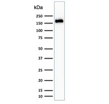 Podocalyxin Antibody