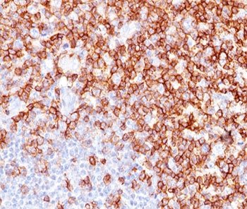 CD45RO Antibody