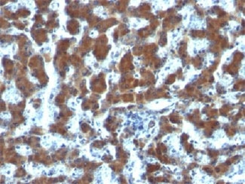 RBP Antibody / Retinol Binding Protein 1