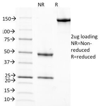 RBP Antibody / Retinol Binding Protein 1