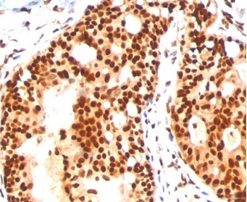 SUMO2/3 Antibody