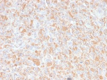 TNF alpha Antibody