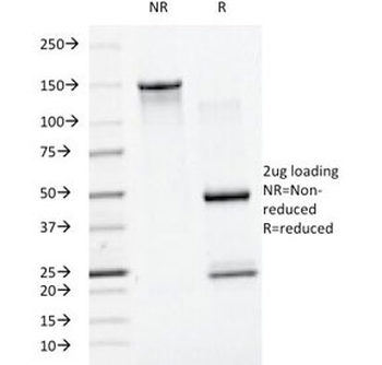 SUMO1 Antibody