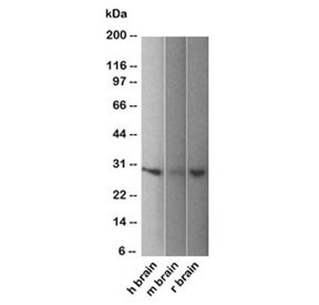 PGP9.5 Antibody / UchL1