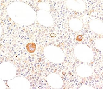 von Willebrand Factor Antibody