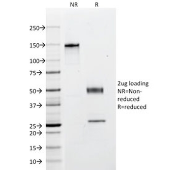 Multi Cytokeratin Antibody 4/5/6/8/10/13/18
