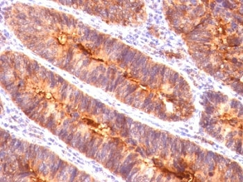 EMA Antibody / MUC1 / Mucin-1