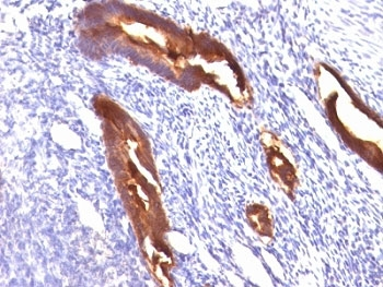 EMA Antibody / MUC1 / Mucin-1