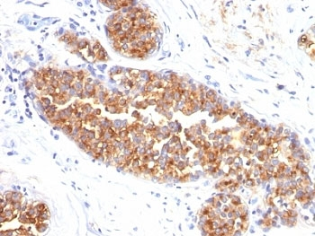 EMA Antibody / MUC1 / Mucin-1