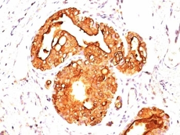 EMA Antibody / MUC1 / Mucin-1
