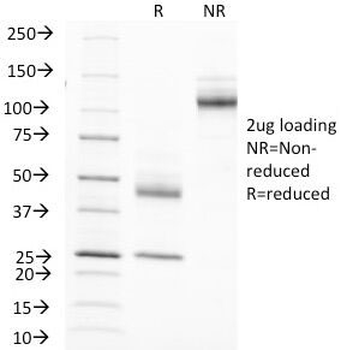 EMA Antibody / MUC1 / Mucin-1