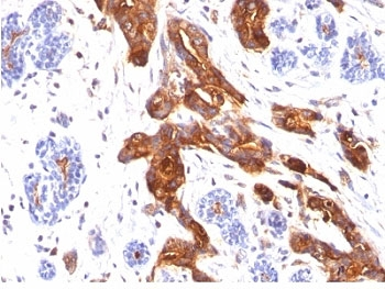 EMA Antibody / MUC1 / Mucin-1