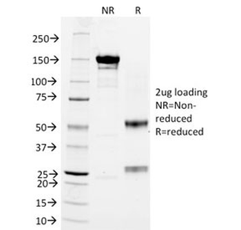 CD3 Antibody / CD3e