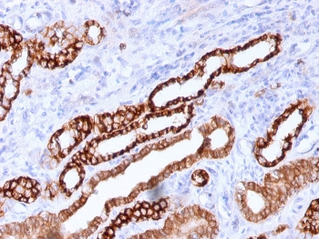Cadherin 16 Antibody