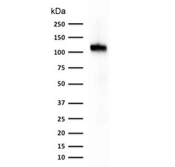 Cadherin 16 Antibody