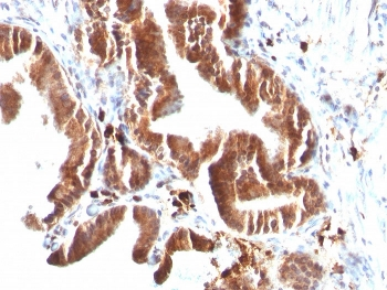 TOP1MT Antibody