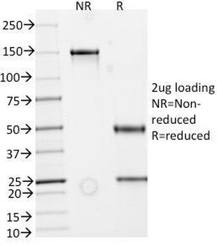 Recombinant Secretory Component Glycoprotein Antibody / ECM1