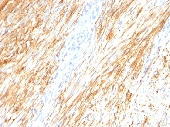 GFAP Antibody
