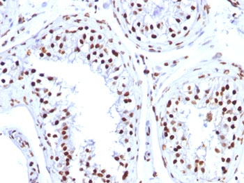 Histone Antibody / Histone H1