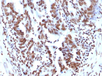 Histone Antibody / Histone H1