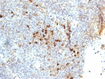 HLA-DR Antibody (MHC II)
