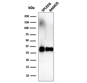 HLA-DRB1 Antibody (MHC II)