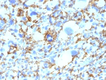 HLA-DRB1 Antibody (MHC II)