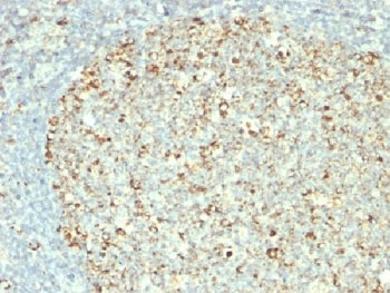HSP60 Antibody / HSPD1