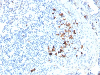 IgA Antibody