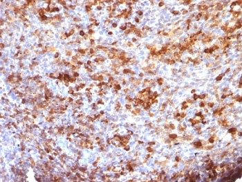 IgG Antibody
