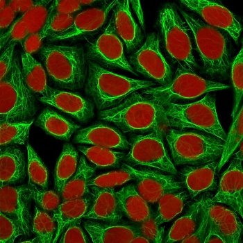 Keratin 18 Antibody