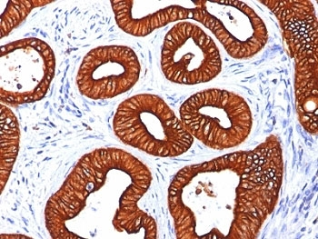 Cytokeratin 18 Antibody