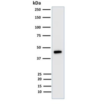 Cytokeratin 18 Antibody