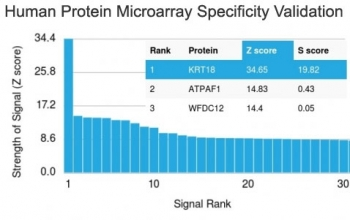 Cytokeratin 18 Antibody