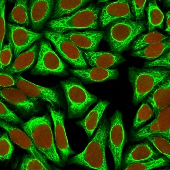 CK18 Antibody / Cytokeratin 18