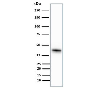 CK18 Antibody / Cytokeratin 18