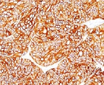 Cytokeratin 18 Antibody Cocktail