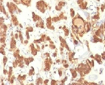 Cytokeratin 18 Antibody Cocktail