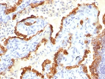 Cytokeratin 18 Antibody Cocktail