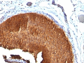 Cytokeratin 19 Antibody