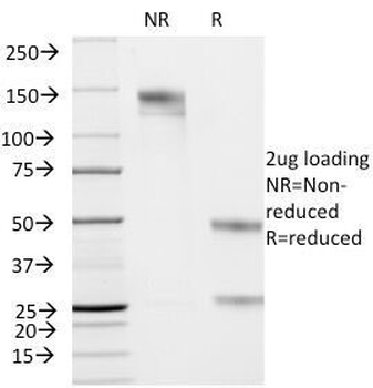 Cytokeratin 19 Antibody