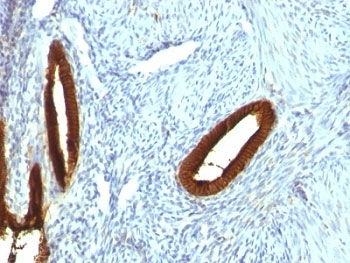 CK19 Antibody / Cytokeratin 19