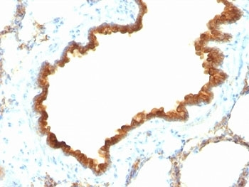 CK19 Antibody / Cytokeratin 19