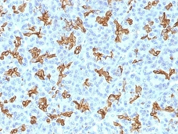 CK19 Antibody / Cytokeratin 19