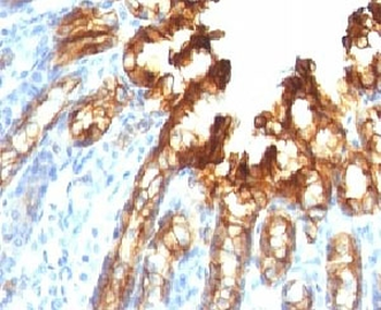 CK19 Antibody / Cytokeratin 19