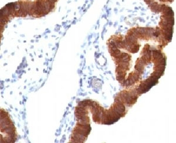 Cytokeratin 19 Antibody Cocktail