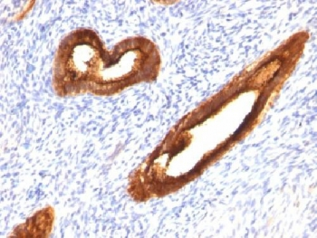 MUC1 Antibody / Mucin-1 / EMA